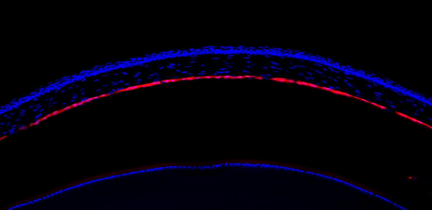 Fluorescence microscopy showing RNA delivery in retinal tissue